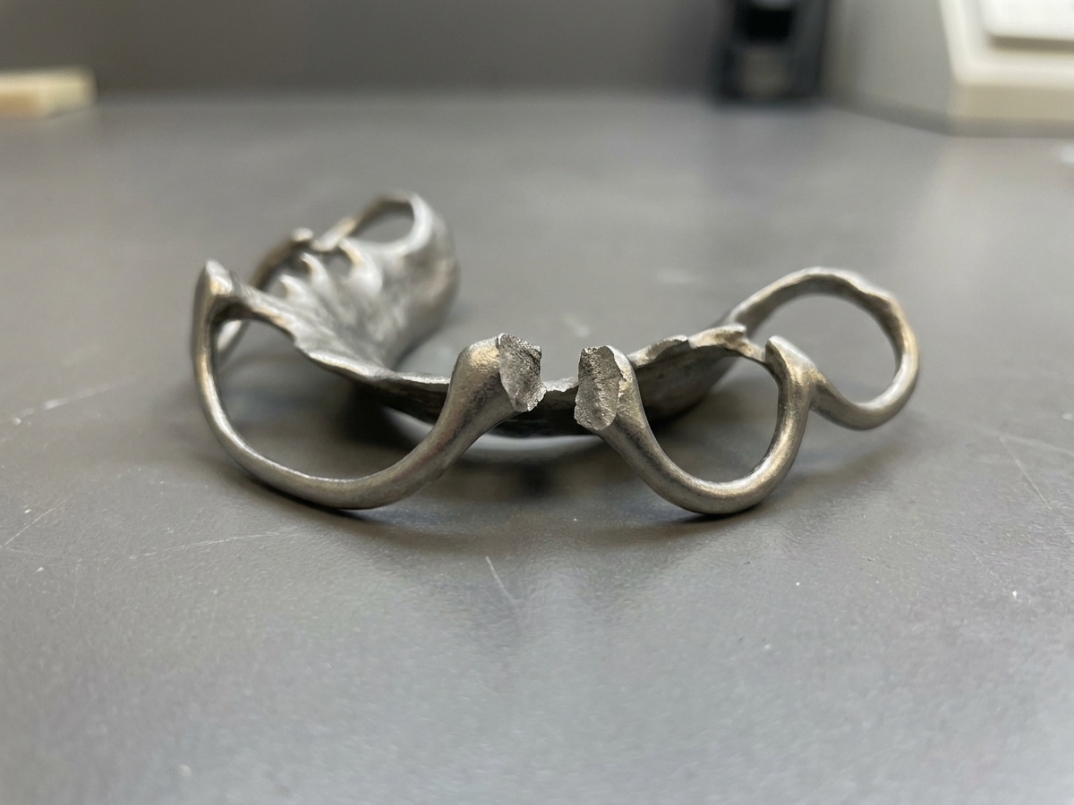 Cast partial denture framework with a clasp arm broken at the junction